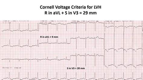 minimum voltage criteria for lvh